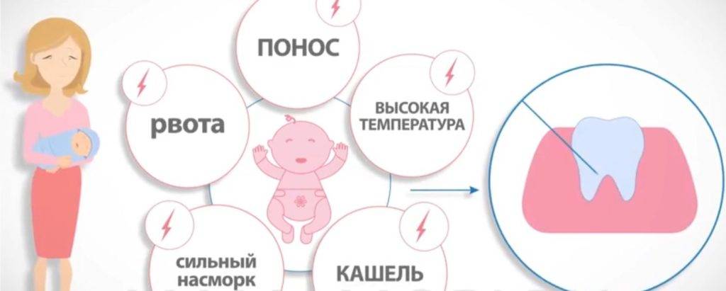Понос при прорезывании зубов: сколько длится и нужно ли лечить