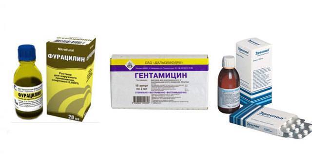 Трахеобронхит: характерные симптомы и лечение