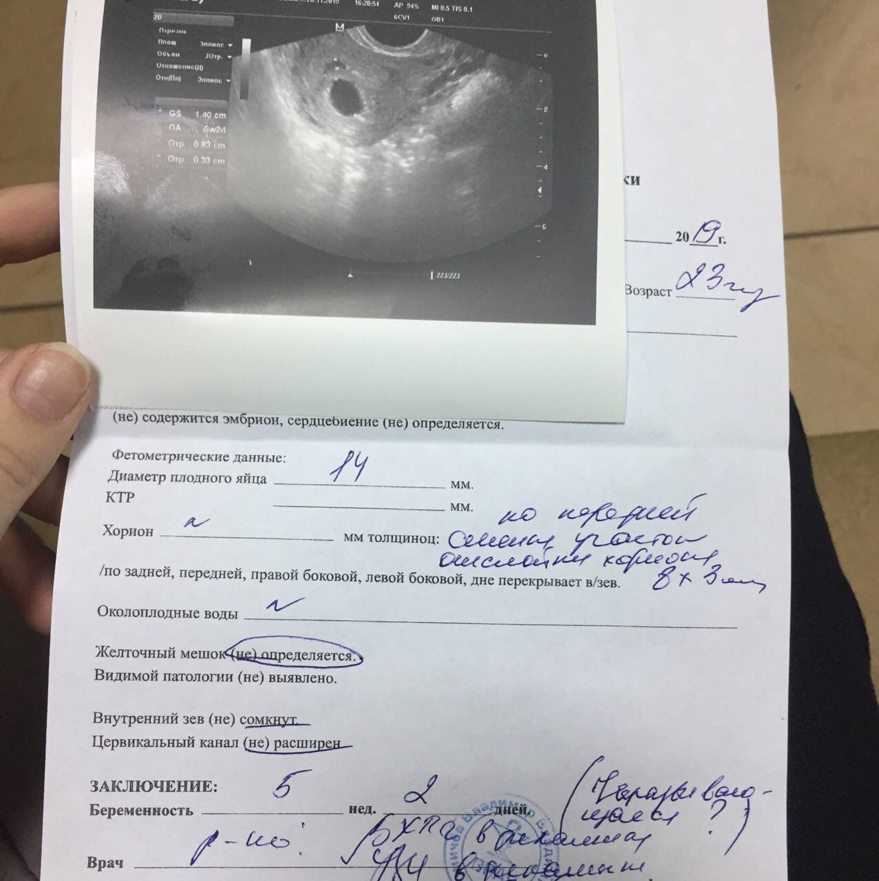 На каком сроке узи покажет беременность