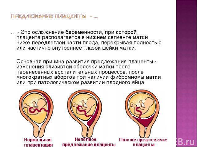 Низкая плацентация при беременности: что это значит и как поднять плаценту?