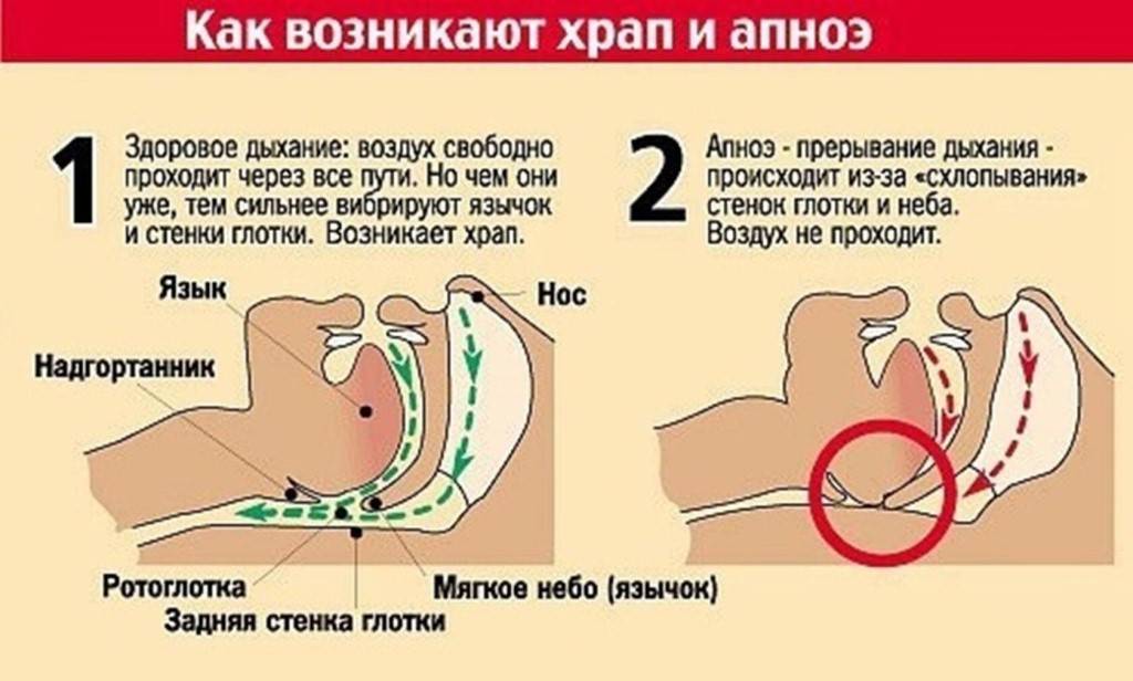 Именитый педиатр пояснил, почему ребенок храпит во сне