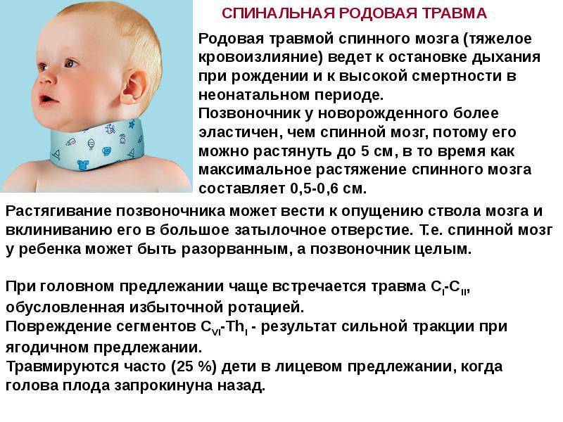 Причины перелома костей черепа у новорожденных