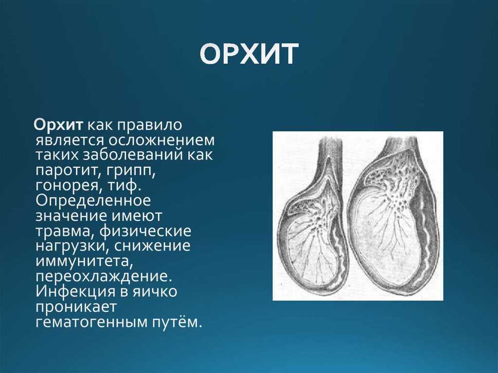 Гипоплазия яичек