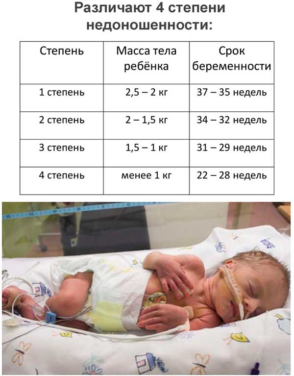 Недоношенные дети | растим здорового ребенка - agulife.ru