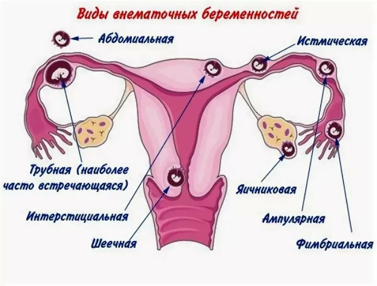 Беременность с одним яичником. делимся опытом и советами. - спроси у бывалых - страна мам