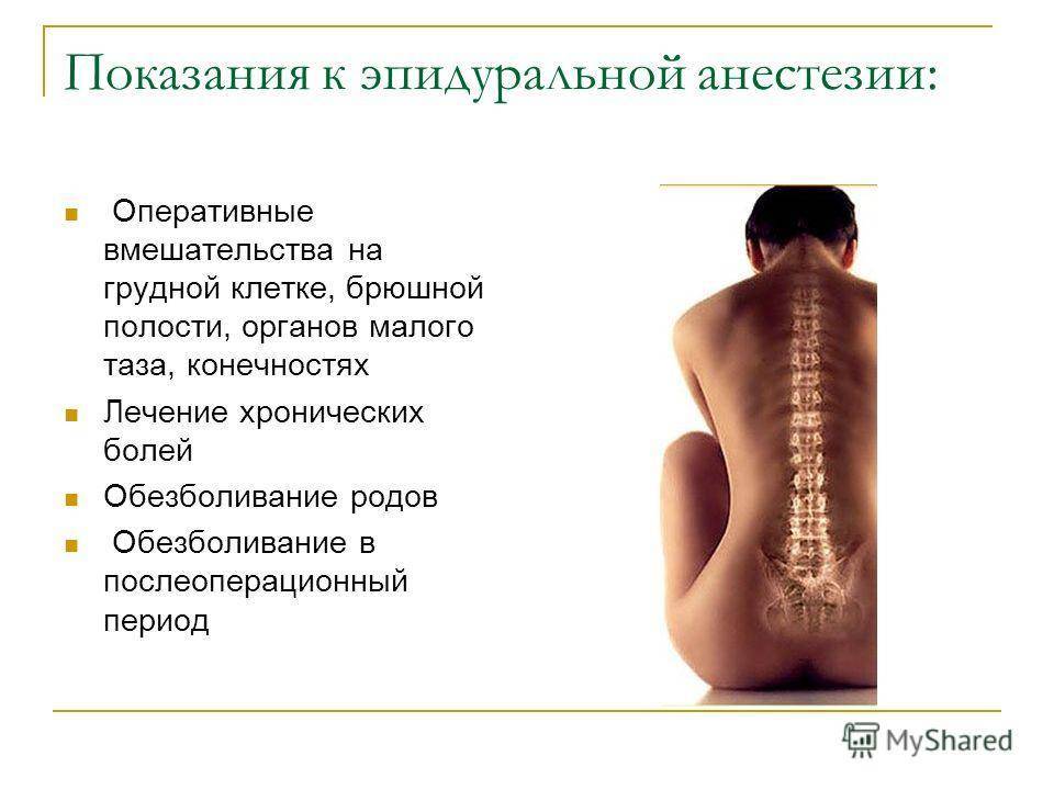 Боль в спине после эпидуральной анестезии: лечение, причины, продолжительность болей