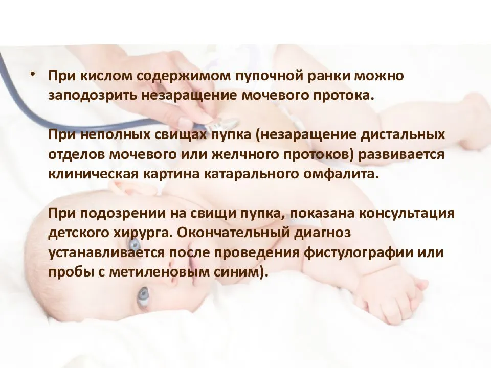 Омфалит у новорожденных (гнойный, катаральный): фото, симптомы, лечение пупка
