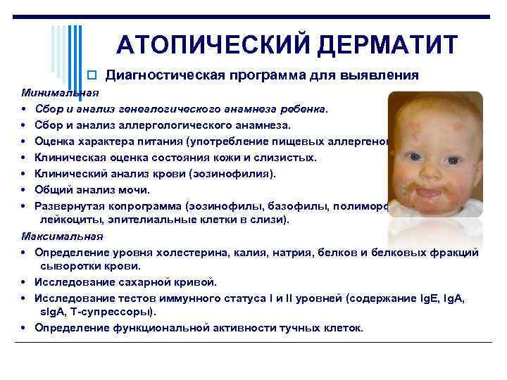 Атопический дерматит у детей > клинические рекомендации рф 2013-2017 (россия) > medelement
