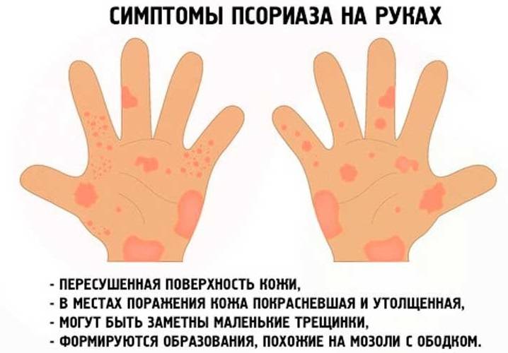 Как устранить шершавость кожи у малышей