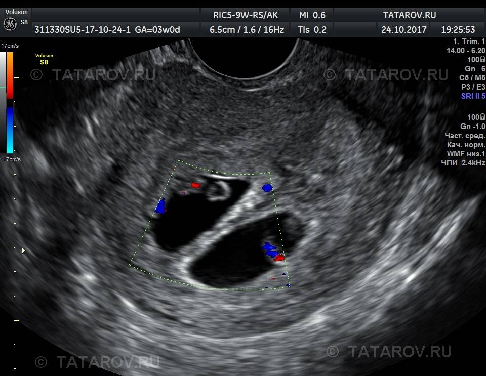 На какой неделе видно эмбрион на узи, сроки, фото