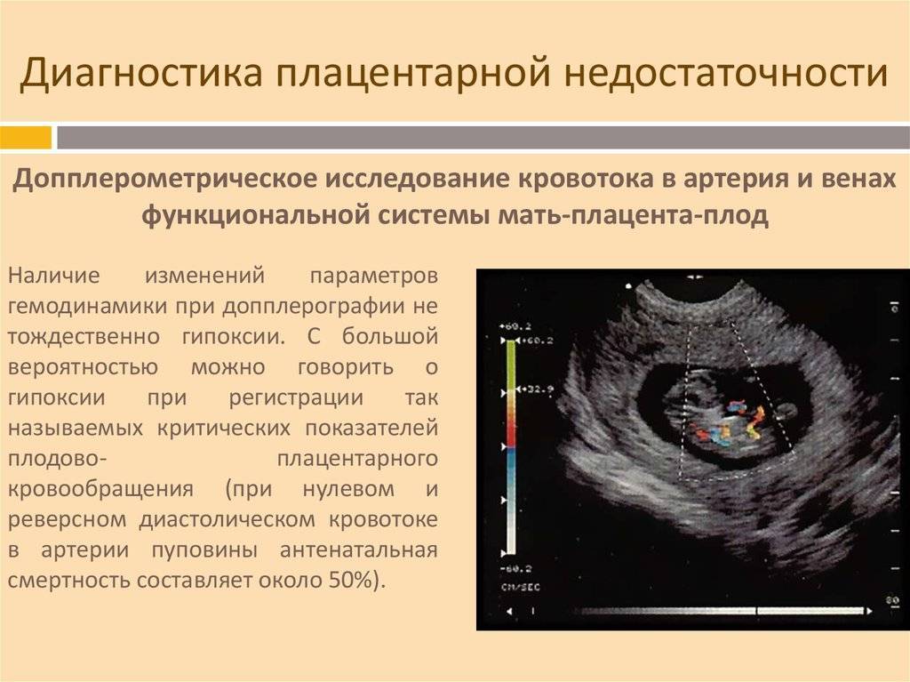 Осложнения беременности: врожденные и приобретенные патологии плода