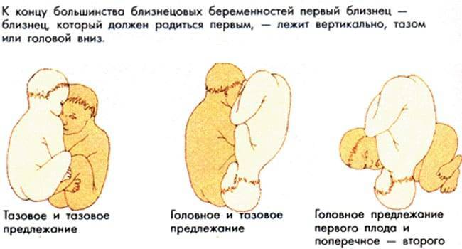 На каком сроке беременности ребенок переворачивается вниз головой и принимает окончательное положение в матке?