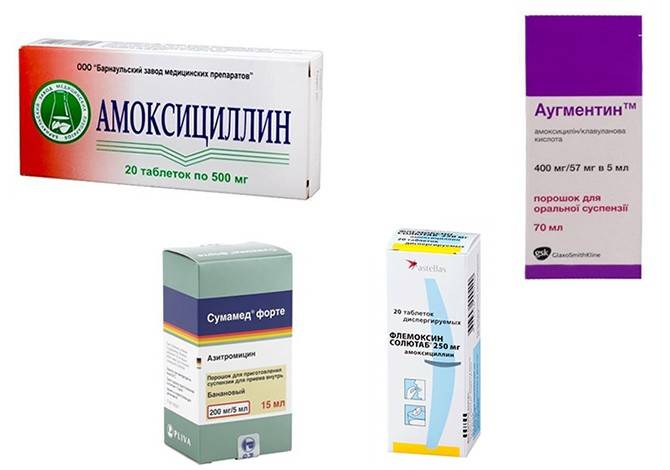 Как лечить лимфоузлы на шее в домашних условиях у детей