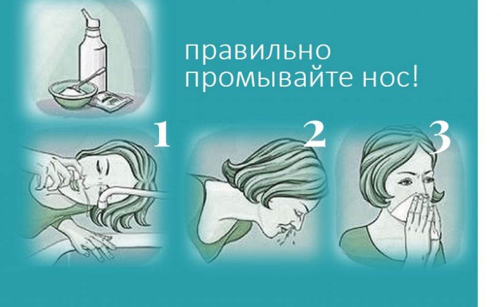 Народные средства от насморка для детей: 10 лучших