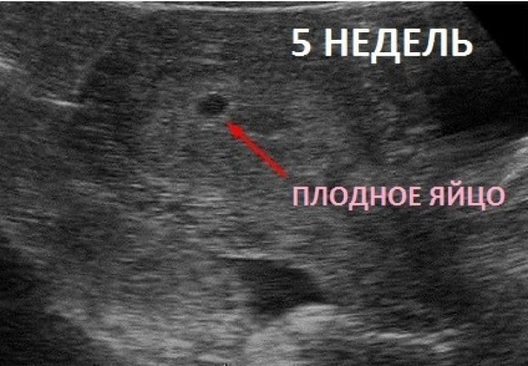 На каком сроке беременности и при каком хгч видно эмбрион: достоверность исследования на первых неделях