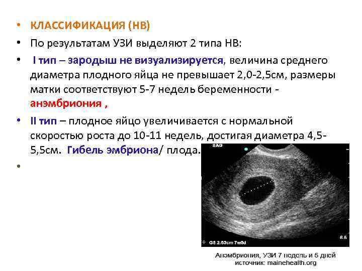 Эмбрион не визуализируется: что это значит, почему на 5–6 неделе беременности не видно зародыша?