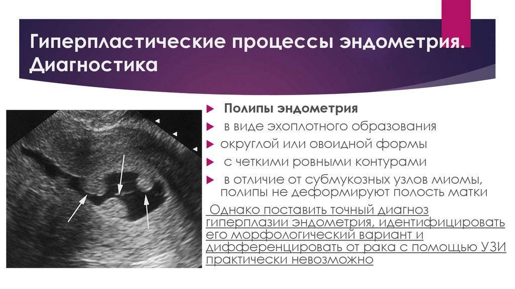Гиперплазия эндометрия ᐉ диагностика, лечение в мц "боголюбы"