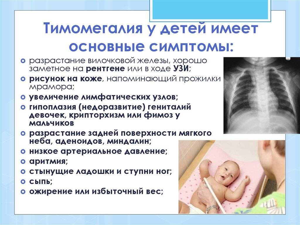 Врожденный стридор - признаки, причины, симптомы, лечение и профилактика - idoctor.kz