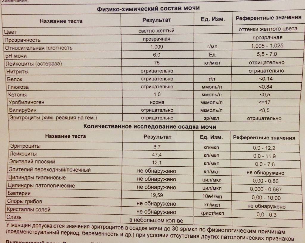 Лейкоциты в моче у ребенка: причины повышения, норма