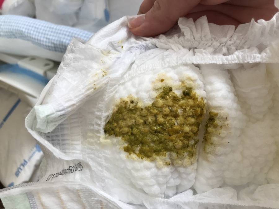 Каким должен быть кал у новорожденного при грудном вскармливании