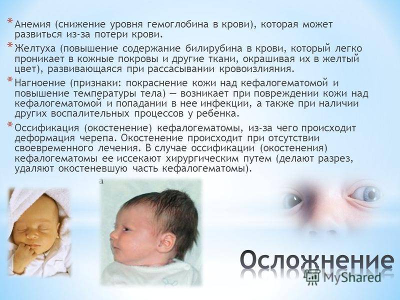 Выявлена гематома у новорожденного на голове после родов: насколько опасно, что делать