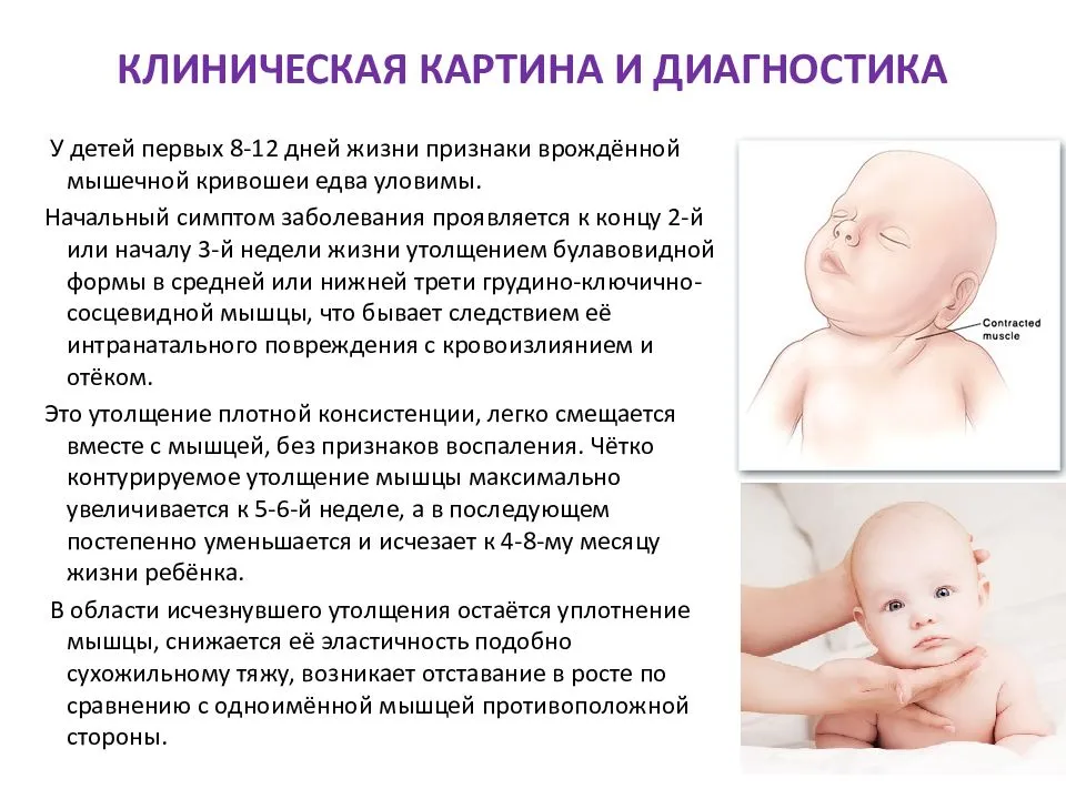 Симптомы врожденного стридора у новорожденных и причины возникновения патологии у детей до года