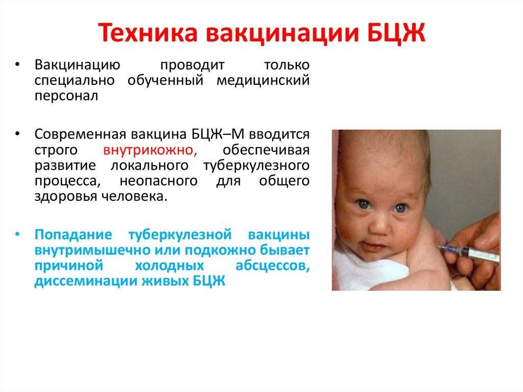 Прививка бцж: когда делают, входит ли в национальный календарь, график вакцинации