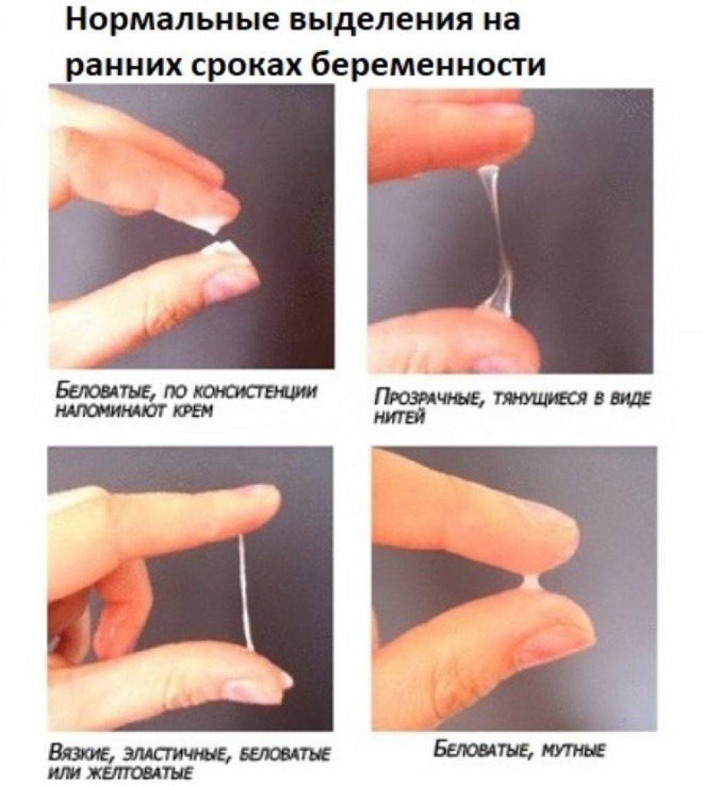 4 возможных причины прозрачных выделений вместо месячных