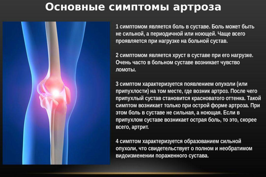 Артрит коленного сустава у детей: симптомы и лечение