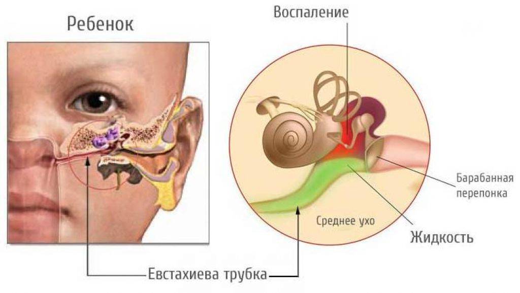 Кровотечение из уха. причины, симптомы и лечение