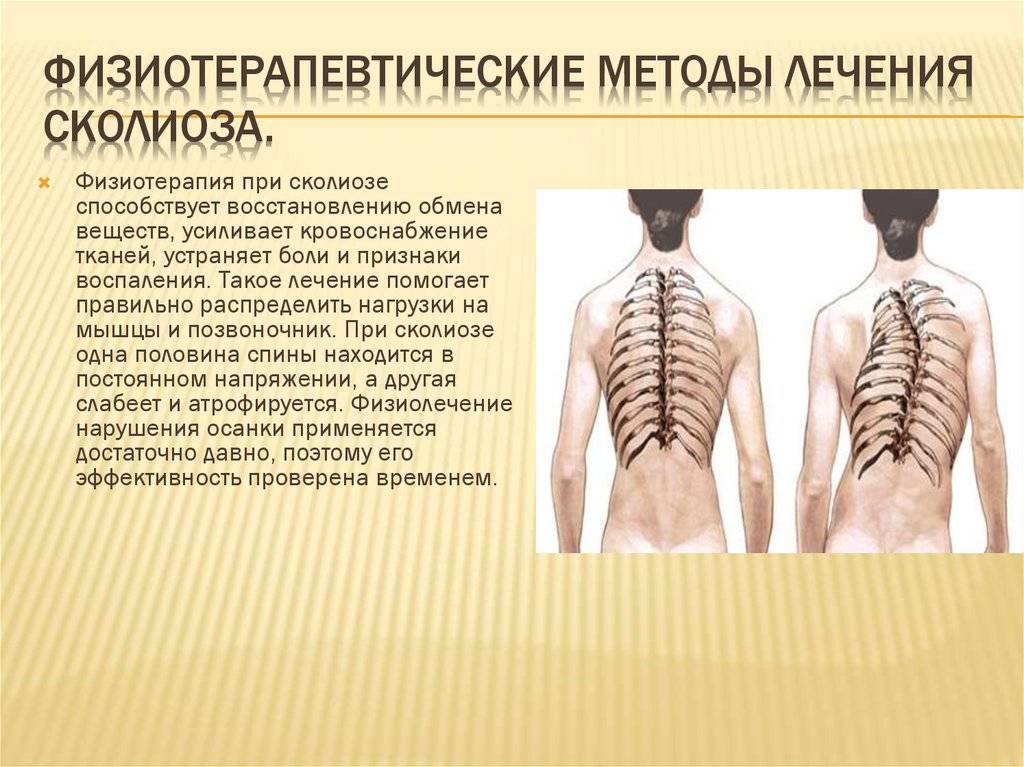 Массаж при сколиозе у детей - правила растирания спины при искривлении позвоночника (видео)