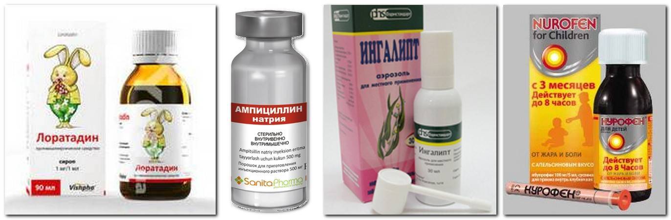 Как быстро вылечить ангину у детей и взрослых