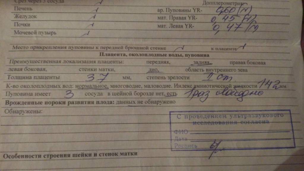 Сколько пульсирует пуповина после родов и почему она должна отпульсировать? почему пуповина должна отпульсировать книга 250 японских узоров скачать бесплатно аквариум на земле