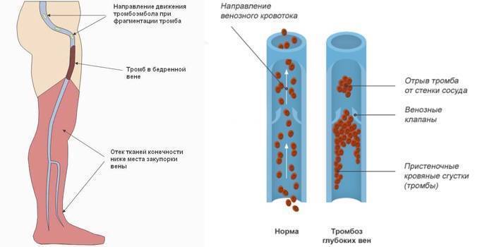 Холодные руки и ноги у ребёнка при температуре - medboli.ru