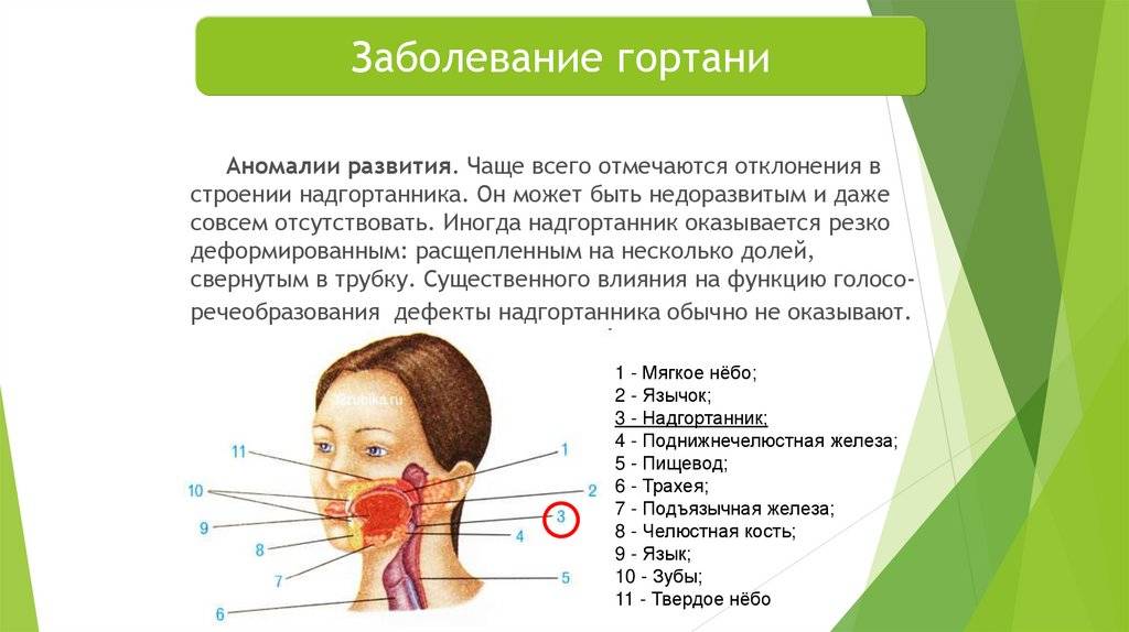 Красное горло у ребёнка: чем лечить, фото, как выглядит, с кашлем, без температуры, в месяц, 2, 3, 1 год