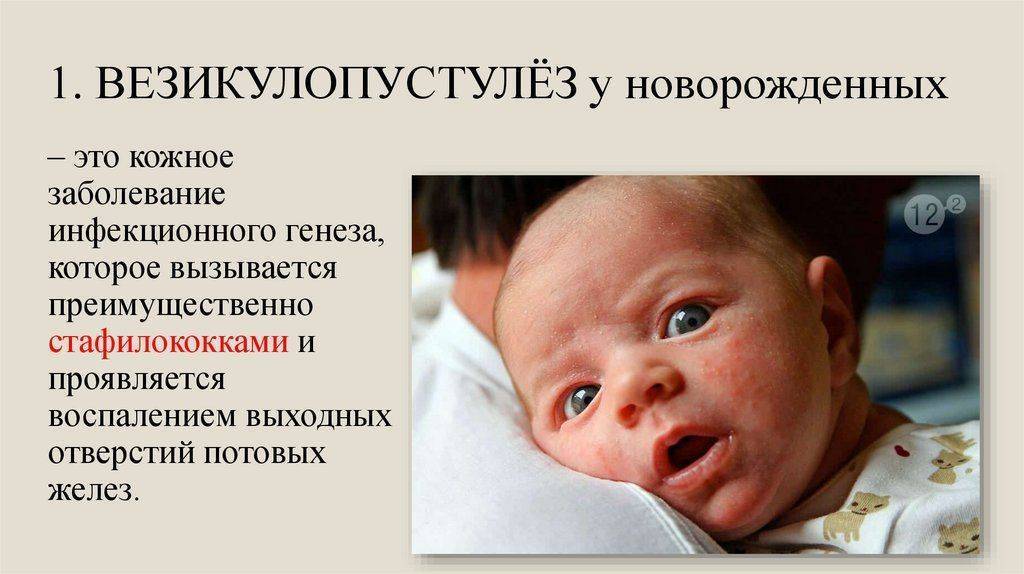 Токсическая эритема новорожденных: причины, лечение