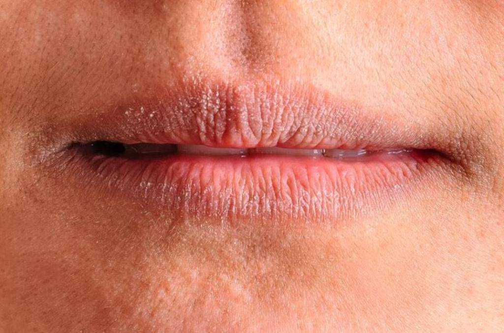 5 причин и способы лечения заед в уголках рта