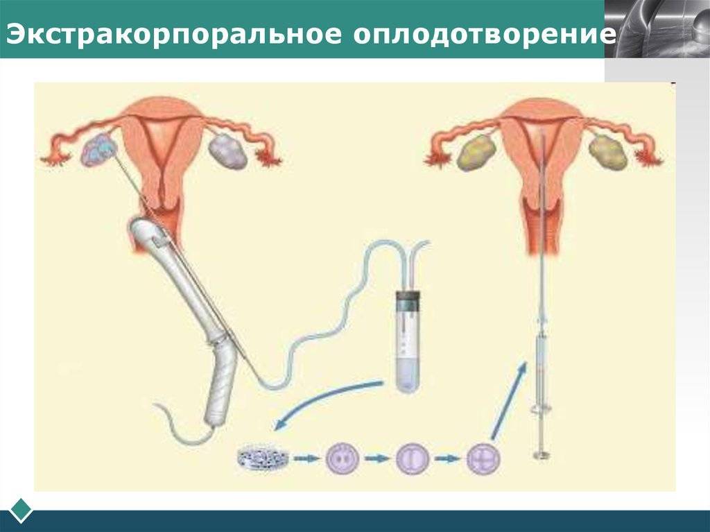 Инсеминация - виды и техники выполнения. возможные осложнения после процедуры. где делают?