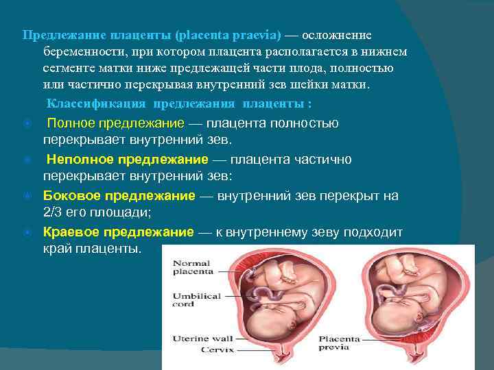 Плацента низко по передней стенке - беременность - страна мам