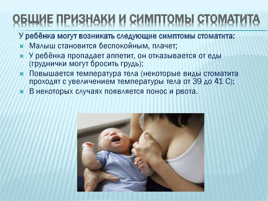 Стоматит у грудничка в полости рта: симптомы, виды заболевания и лечение