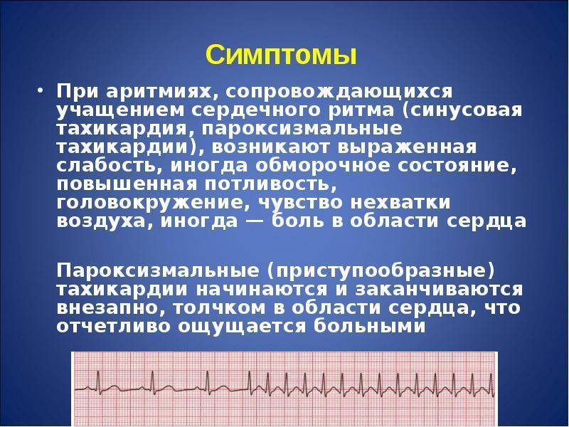 О самых распространённых причинах синусовой аритмии у ребёнка рассказывает детский кардиолог