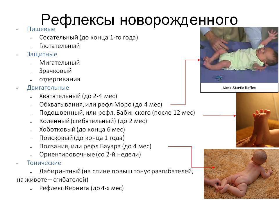 Рефлексы новорожденных: условные и безусловные