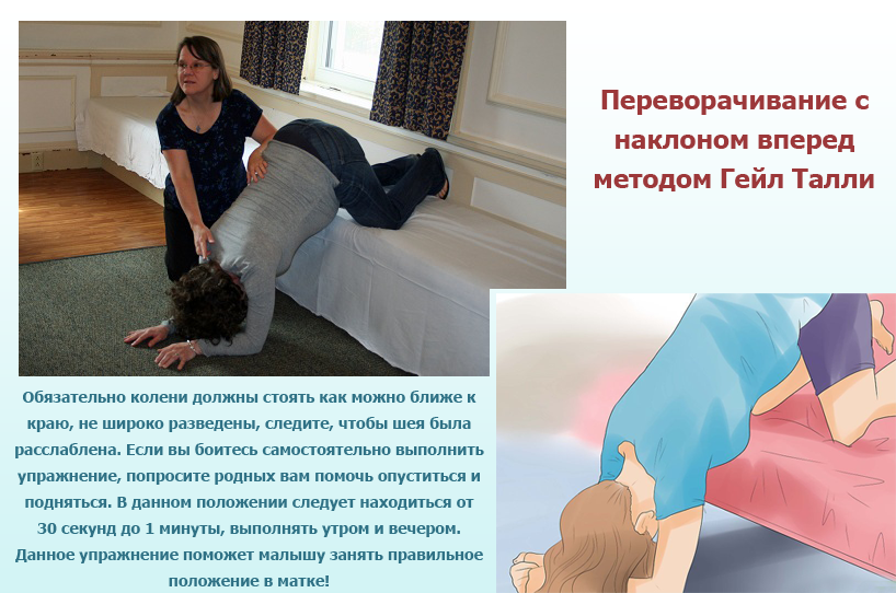 Упражнения для переворота плода в головное предлежание