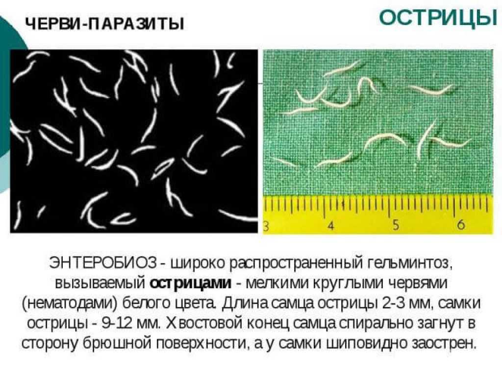 Гельминты у детей: симптомы и лечение, подробная информация