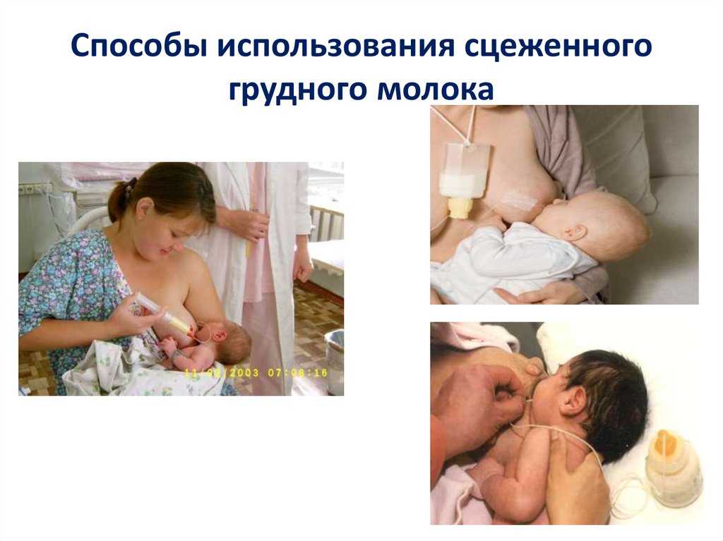 Расцеживание лактостаза на дому: правильная техника, поможет ли молокоотсос?