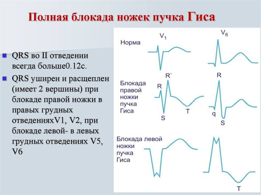 Блокады сердца у детей - симптомы болезни, профилактика и лечение блокад сердца у детей, причины заболевания и его диагностика на eurolab