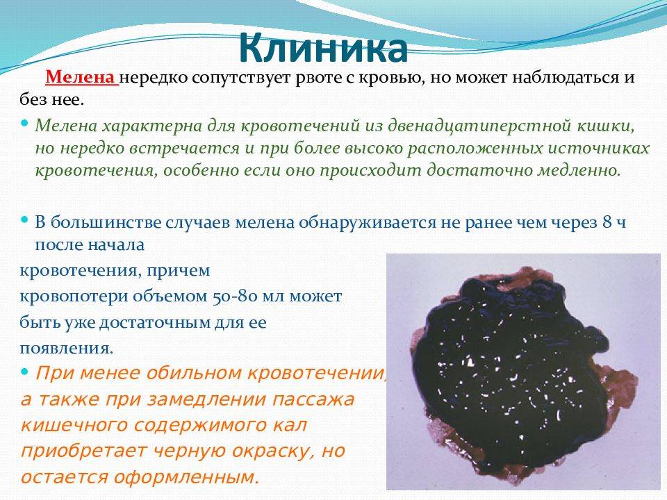 Черный кал у ребенка: почему в стуле появляются темные ниточки и крупинки, точки и прожилки?