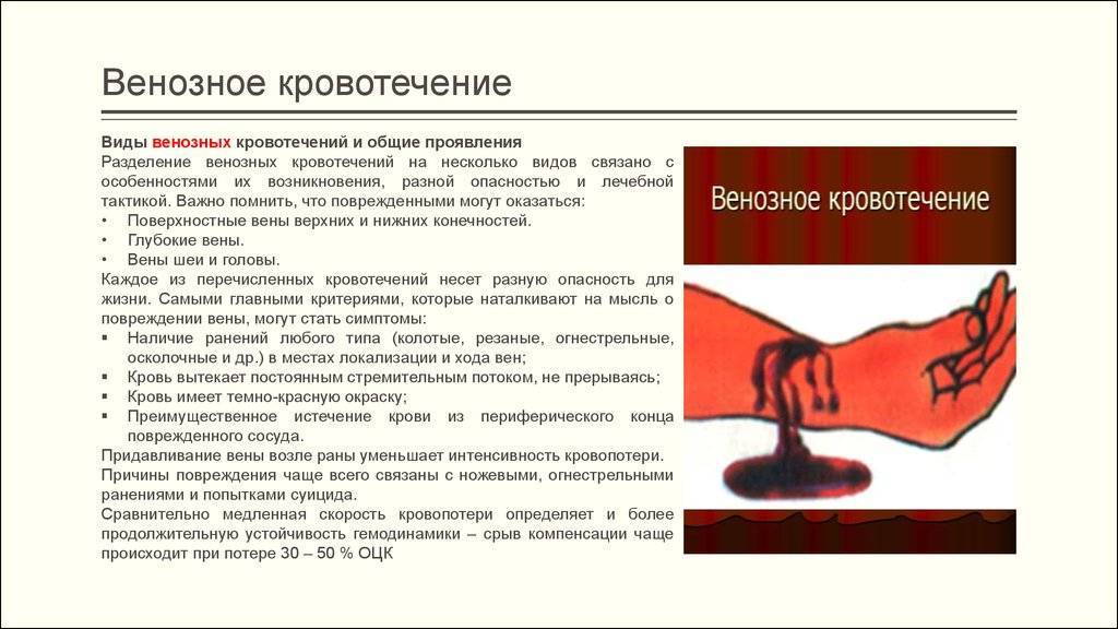 Первая помощь при маточном кровотечении: правила оказания | food and health