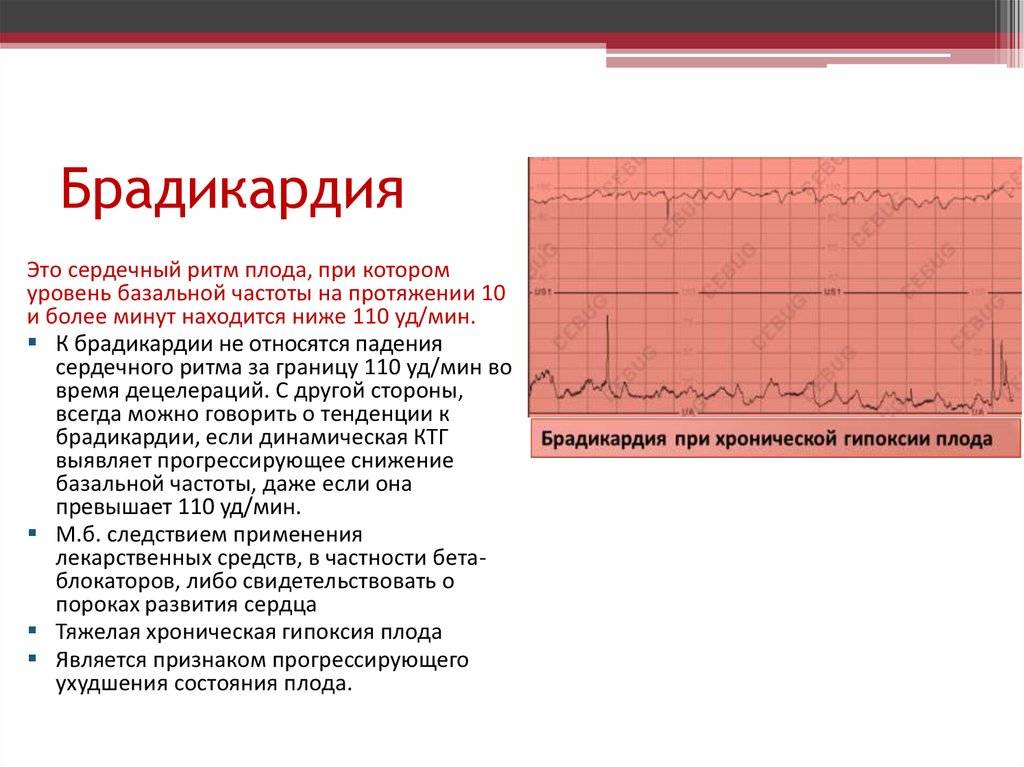 Брадиаритмия плода в акушерской практике: диагностика, возможности терапевтических подходов, профилактика » библиотека врача