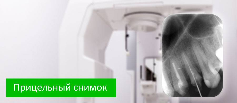 Рентген при планировании беременности: можно ли делать рентгенографию зуба, ноги и прочего?